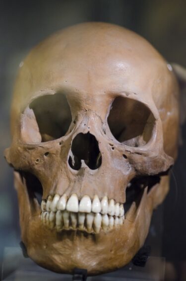 【オーパーツ】フライベルグ・スカル(褐炭の頭蓋骨)